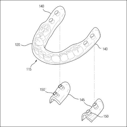 특허 제10-1092905호(임플란트용 스텐트 및 그 제조방법, 이태경)