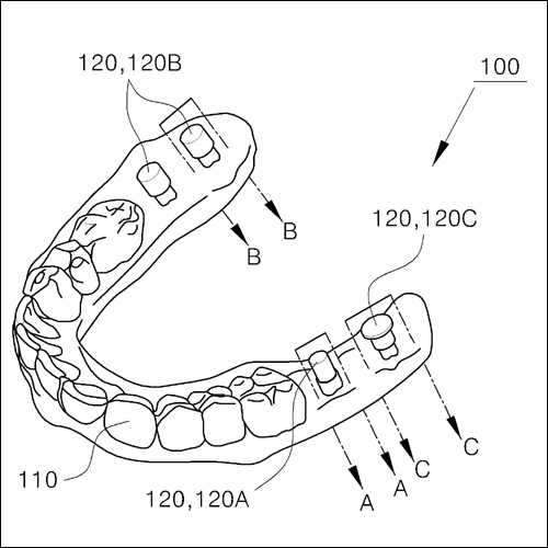 특허 제10-1240357호(임플란트 시술용 구내장착물 제작을 위한 쾌속조형 구강모델 어셈블리 및 이를 이용한 임플란트 시술용 구내장착물의 제작방법, 이태경)
