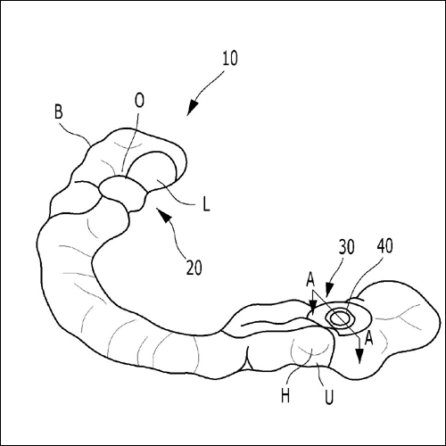 특허 제10-1807829호(정밀한 치과용 임플란트 시술을 위한 가이드 템플릿 및 그 제조방법, 이태경)